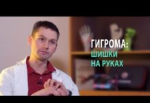 Гигрома запястья: что это? Причины, симптомы, лечение