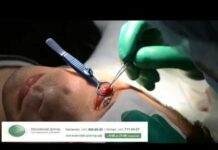 Как прорывается ячмень на глазу; средства, ускоряющие процесс; Глаза Эксперт