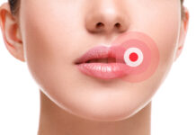 Герпес на губах при беременности в первом триместре, во втором: последствия