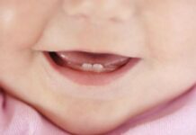 Гель для детских десен для снятия зуда и боли