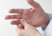 Правильное лечение экземы на руках в клинике ПсорМак, ремиссия до 5-6 лет