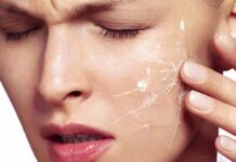 Что делать, если шелушится кожа на лице, как избавиться от шелушения