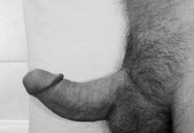 Болезнь Пейрони у мужчин — симптомы, диагностика, фото