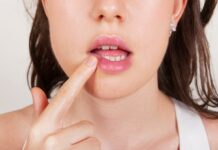 С нами навсегда. Чем опасны спящие вирусы герпеса. Новости общества