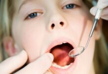 Герпетический стоматит у взрослых: лечение, фото, симптомы