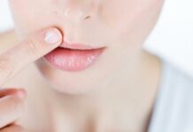 Сколько в больнице лежат с герпесом