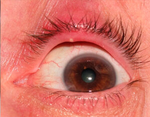 Ячмень: полезные свойства для здоровья | Food and Health