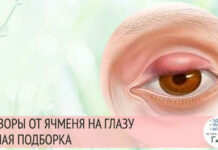 Заговорить ячмень на глазу — все способы — ОНЛАЙН БОЛЬНИЦА
