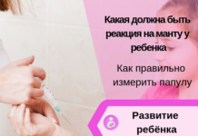 Реакция Манту у детей: нормы и отклонения