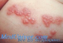 Герпетические инфекции у детей: клиника, диагностика