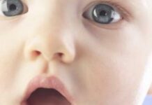 Герпес – стоит ли его опасаться родителям грудничка?