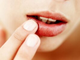 Увеличение паховых лимфоузлов при генитальном герпесе