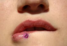 Мифы и правда о герпесе. Какие симптомы помогут обнаружить вирус | Здоровая жизнь | Здоровье | Аргументы и Факты