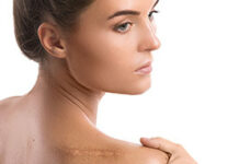 ТОП-6 способов сделать шрам менее заметным