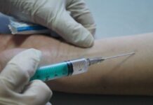 Какая должна быть реакция на Манту: норма и патология