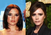 Звезды до и после удаления комков Биша — 300