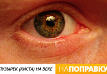 Проблемы на веках глаза: причины и что делать – НаПоправку