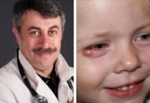 Можно ли гулять с ячменем на глазу — ОНЛАЙН БОЛЬНИЦА