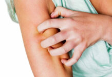 Опоясывающий лишай: признаки и лечение