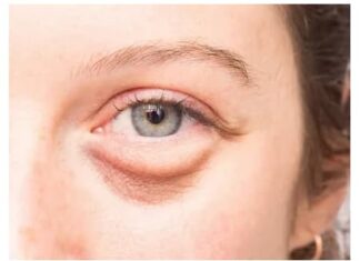 Отек века: описание болезни, причины, симптомы, стоимость лечения в Москве | метро Полянка, Серпуховская, Добрынинская