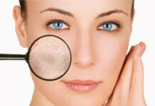 Сухая кожа лица – что делать? Экспертные советы по уходу за сухим типом кожи.