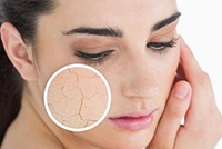 Почему шелушится кожа на лице