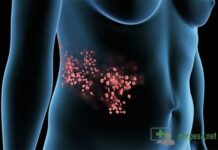 Герпес на животе – фото, лечение и причины–