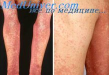 Сыпь при инфекционных болезнях. Сопутствующие симптомы инфекции