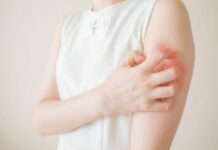 ПОРТРЕТ БОЛЕЗНИ» НА КОЖЕ. КАКУЮ РОЛЬ В ВОЗНИКНОВЕНИИ АЛЛЕРГИИ ИГРАЮТ ГЕЛЬМИНТЫ? | Читайте в журнале Столетник