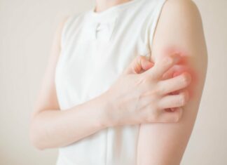 ПОРТРЕТ БОЛЕЗНИ» НА КОЖЕ. КАКУЮ РОЛЬ В ВОЗНИКНОВЕНИИ АЛЛЕРГИИ ИГРАЮТ ГЕЛЬМИНТЫ? | Читайте в журнале Столетник