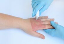 Левомеколь мазь — инструкция по применению, от чего помогает, для чего применяется?