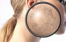 Покраснение и шелушение кожи на лице: причины