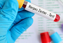 Лечат ли зубы при герпесе или нельзя?