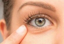 Халязион и ячмень: причины, симптомы, лечение — Профессорская клиника