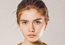 Какие анализы нужно сдать у дерматолога при подозрении на акне? | Лечение акне и розацеа препаратом Азелик®