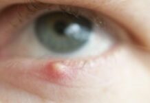 Таблетки от ячменя на глазу и другие препараты