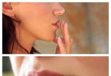 Как вылечить герпес за 1 день | Вирус Герпес