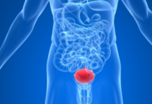 Везикулит: лечение, симптомы у мужчин, последствия