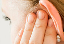 Черные точки в ушах: как избавиться от комедонов — Дерма