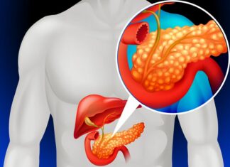 Панкреатит: воспаление поджелудочной железы — симптомы, лечение, диета