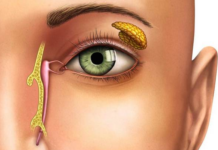 Слизь в уголках глаз: почему она появляется и о чем говорит?