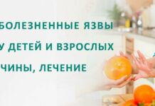 Афты во рту: причины, лечение — стоматология Блеск Новосибирск