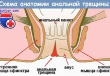 Причины изъязвлений в колопроктологии и обследование при них