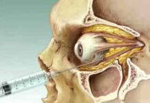 Анестезия и обезболивание в офтальмологии — что выбрать
