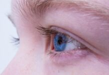 Опухание век, покраснение — причины, лечение