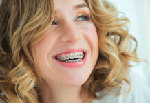 Белые язвочки во рту — причины и лечение