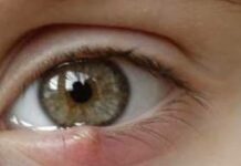 Как вылечить ячмень на глазу за 1 день — народные средства от ячменя на глазу