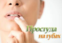 Герпес на губах: быстрое лечение, мазь, причины возникновения простуды на губе — Поликлиника №8