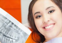 Особенности имплантации зубов