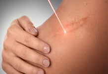 Как убрать рубцы и шрамы на теле